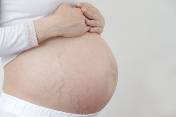 Một số vấn đề mẹ bầu thường gặp phải trong quá trình mang thai 2